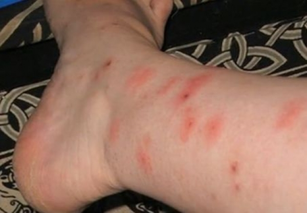 Fenomen straniu în această perioadă. Sătmăreni înțepați de INSECTE