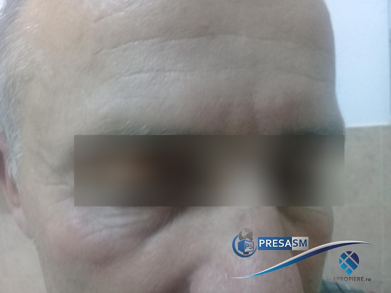 FOTO. Plângere penală. Familia unui bolnav susține că a fost bătut în Spitalul Județean