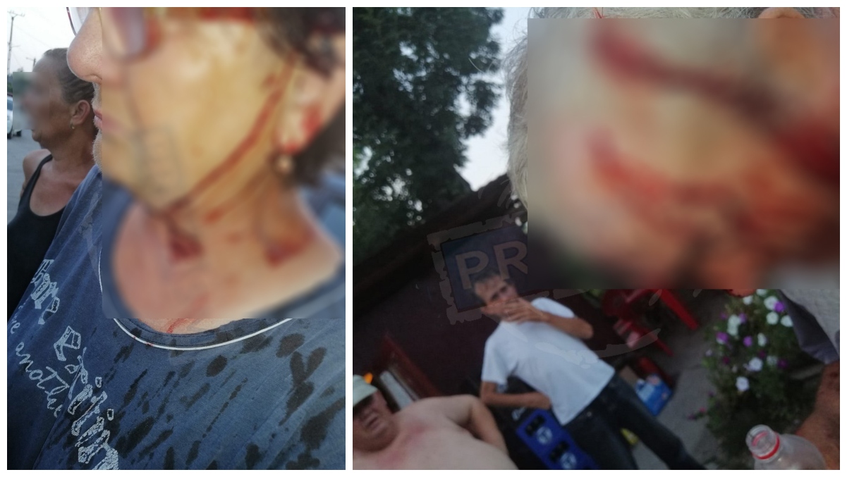 FOTO. Sătmăreni, soț și soție, agresați la o terasă din județul Satu Mare